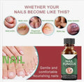 Fast Nail Fungus Treatment Serum