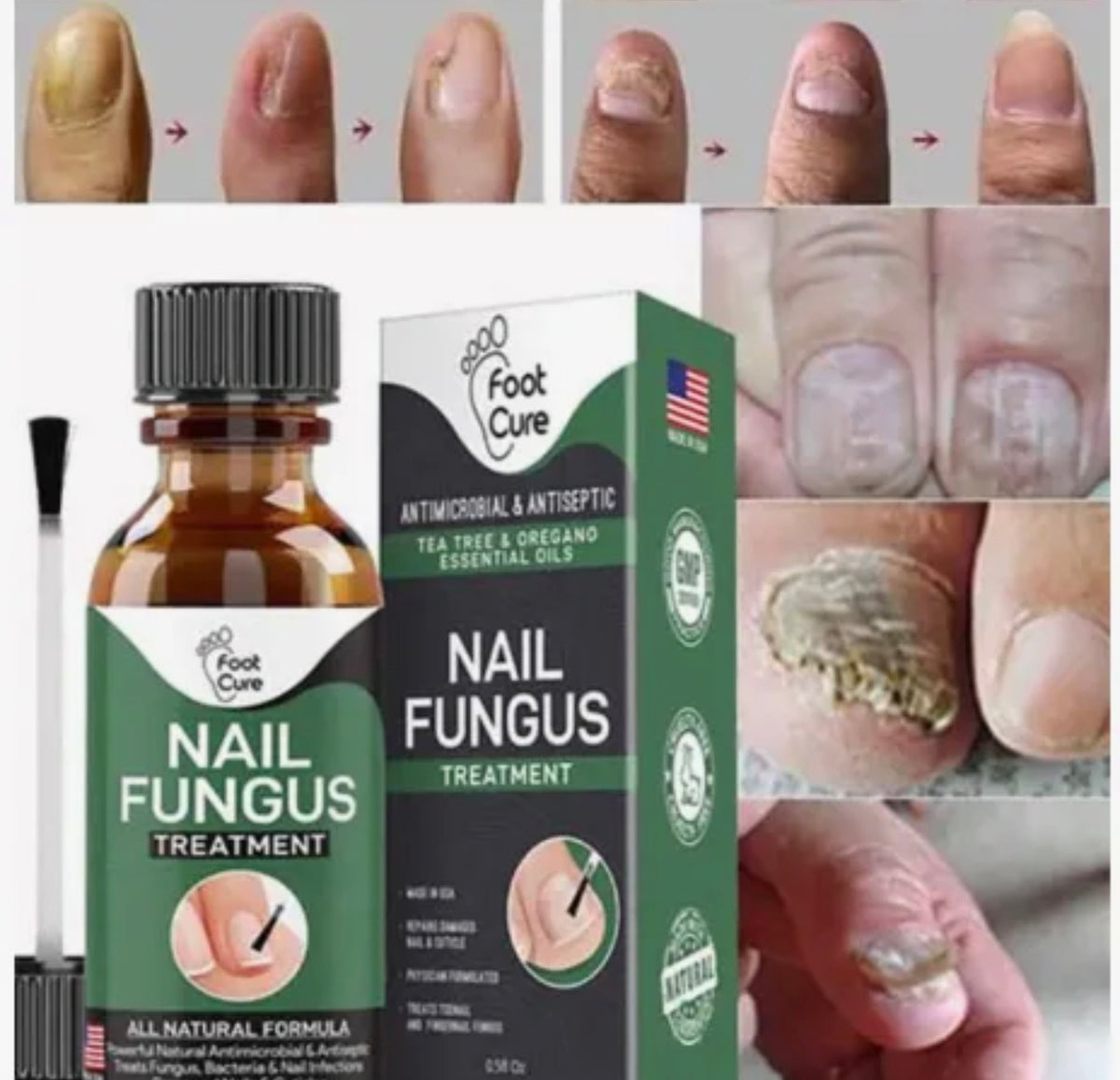 Fast Nail Fungus Treatment Serum